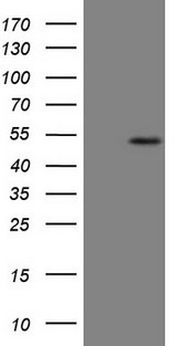 B4GALT4 Antibody - HEK293T cells were transfected with the pCMV6-ENTRY control. (Left lane) or pCMV6-ENTRY B4GALT4. (Right lane) cDNA for 48 hrs and lysed. Equivalent amounts of cell lysates. (5 ug per lane) were separated by SDS-PAGE and immunoblotted with anti-B4GALT4. (1:500)
