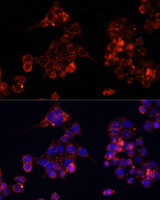 B4GALT4 Antibody - Immunofluorescence analysis of HeLa cells using B4GALT4 antibody at dilution of 1:100. Blue: DAPI for nuclear staining.