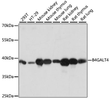 B4GALT4 Antibody - Western blot analysis of extracts of various cell lines, using B4GALT4 antibody at 1:1000 dilution. The secondary antibody used was an HRP Goat Anti-Rabbit IgG (H+L) at 1:10000 dilution. Lysates were loaded 25ug per lane and 3% nonfat dry milk in TBST was used for blocking. An ECL Kit was used for detection and the exposure time was 1s.