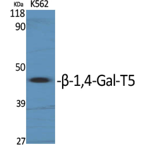 B4GALT5 Antibody - Western blot of beta-1,4-Gal-T5 antibody