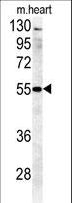 B4GALT5 Antibody - B4GALT5 Antibody western blot of mouse heart tissue lysates (35 ug/lane). The B4GALT5 antibody detected B4GALT5 protein (arrow).