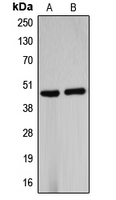 B4GALT5 Antibody - Western blot analysis of B4GALT5 expression in HUVEC (A); mouse kidney (B) whole cell lysates.