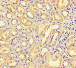 B4GALT5 Antibody - Immunohistochemistry of paraffin-embedded human kidney tissue using B4GALT5 Antibody at dilution of 1:100