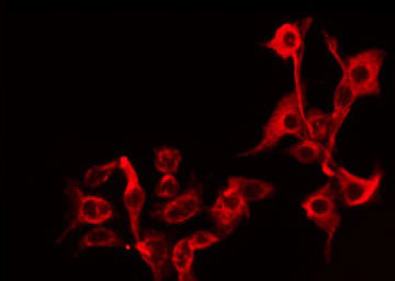 B4GALT5 Antibody - Staining HuvEc cells by IF/ICC. The samples were fixed with PFA and permeabilized in 0.1% Triton X-100, then blocked in 10% serum for 45 min at 25°C. The primary antibody was diluted at 1:200 and incubated with the sample for 1 hour at 37°C. An Alexa Fluor 594 conjugated goat anti-rabbit IgG (H+L) Ab, diluted at 1/600, was used as the secondary antibody.