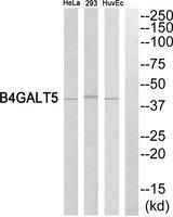 B4GALT5 Antibody - Western blot analysis of extracts from HeLa cells, HuvEc cells and 293 cells, using B4GALT5 antibody.