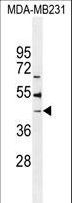 B4GALT6 Antibody - B4GALT6 Antibody western blot of MDA-MB231 cell line lysates (35 ug/lane). The B4GALT6 antibody detected the B4GALT6 protein (arrow).