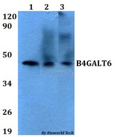 B4GALT6 Antibody - Western blot of B4GALT6 antibody at 1:500 dilution. Lane 1: HEK293T whole cell lysate. Lane 2: A549 whole cell lysate. Lane 3: sp2/0 whole cell lysate.