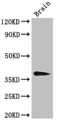 B4GALT7 Antibody - Western Blot Positive WB detected in:Mouse brain tissue All Lanes:B4GALT7 antibody at 3µg/ml Secondary Goat polyclonal to rabbit IgG at 1/50000 dilution Predicted band size: 38 KDa Observed band size: 38 KDa