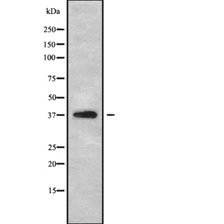 B4GALT7 Antibody - Western blot analysis of B4GALT7 using A549 whole cells lysates