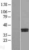 B4GALT7 Protein - Western validation with an anti-DDK antibody * L: Control HEK293 lysate R: Over-expression lysate
