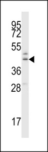 B4GAT1 / B3GNT1 Antibody - B3GNT1 Antibody western blot of MDA-MB435 cell line lysates (35 ug/lane). The B3GNT1 antibody detected the B3GNT1 protein (arrow).