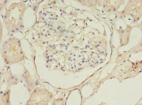 B4GAT1 / B3GNT1 Antibody - Immunohistochemistry of paraffin-embedded human kidney using antibody at 1:100 dilution.  This image was taken for the unconjugated form of this product. Other forms have not been tested.