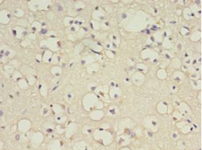 B4GAT1 / B3GNT1 Antibody - Immunohistochemistry of paraffin-embedded human brain using antibody at 1:100 dilution.  This image was taken for the unconjugated form of this product. Other forms have not been tested.