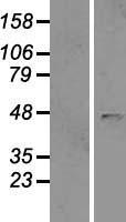B4GAT1 / B3GNT1 Protein - Western validation with an anti-DDK antibody * L: Control HEK293 lysate R: Over-expression lysate