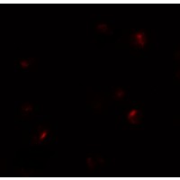 B9D1 Antibody - Immunofluorescence of B9D1 in 293 cells with B9D1 antibody at 20 µg/mL.