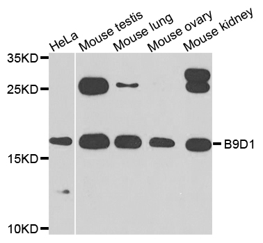 B9D1 Antibody - Western blot analysis of extracts of various cells.
