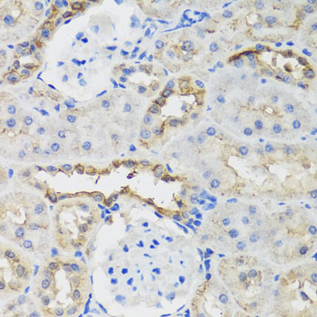 B9D1 Antibody - Immunohistochemistry of paraffin-embedded rat kidney tissue.