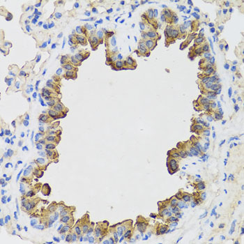 B9D1 Antibody - Immunohistochemistry of paraffin-embedded mouse lung tissue.