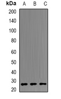 B9D1 Antibody - Western blot analysis of B9D1 expression in HeLa (A); mouse lung (B); mouse kidney (C) whole cell lysates.