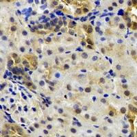 B9D1 Antibody - Immunohistochemical analysis of B9D1 staining in rat kidney formalin fixed paraffin embedded tissue section. The section was pre-treated using heat mediated antigen retrieval with sodium citrate buffer (pH 6.0). The section was then incubated with the antibody at room temperature and detected using an HRP conjugated compact polymer system. DAB was used as the chromogen. The section was then counterstained with hematoxylin and mounted with DPX.
