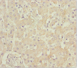 B9D1 Antibody - Immunohistochemistry of paraffin-embedded human liver tissue at dilution 1:100