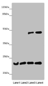 B9D1 Antibody - Western blot All Lanes: B9D1 antibody at 6.61 ug/ml Lane 1: Mouse lung tissue Lane 2: Mouse gonadal tissue Lane 3: Hela whole cell lysate Lane 4: 293T whole cell lysate Secondary Goat polyclonal to rabbit IgG at 1/10000 dilution Predicted band size: 23,17 kDa Observed band size: 23,45 kDa