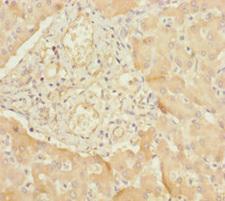 B9D1 Antibody - Immunohistochemistry of paraffin-embedded human liver tissue at dilution 1:100