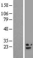 B9D2 Protein - Western validation with an anti-DDK antibody * L: Control HEK293 lysate R: Over-expression lysate