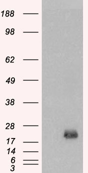 BAALC Antibody - HEK293 overexpressing BAALC (RC203701) and probed with (mock transfection in first lane).
