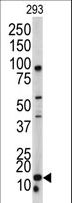 BAALC Antibody - Western blot of BAALC antibody in 293 cell line lysates (35 ug/lane). BAALC (arrow) was detected using the purified antibody.