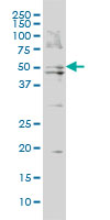 BAAT / BAT Antibody - BAAT monoclonal antibody (M02), clone 5B6 Western Blot analysis of BAAT expression in HepG2.