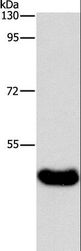 BAAT / BAT Antibody - Western blot analysis of Human normal liver tissue, using BAAT Polyclonal Antibody at dilution of 1:600.