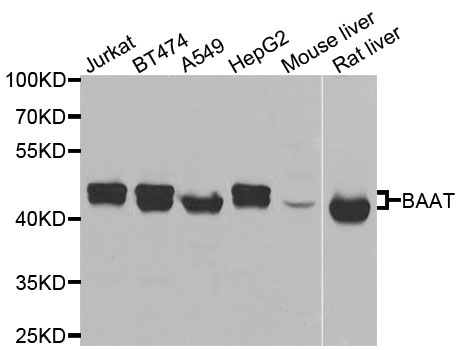 BAAT / BAT Antibody - Western blot analysis of extracts of various cells.