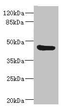BAAT / BAT Antibody - Western blot All Lanes: BAAT antibody IgG at 3.73ug/ml+ Mouse liver tissue Secondary Goat polyclonal to rabbit IgG at 1/10000 dilution Predicted band size: 46 kDa Observed band size: 46 kDa