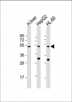 BAAT / BAT Antibody - All lanes: Anti-BAAT Antibody (N-Term) at 1:2000 dilution Lane 1: human liver lysate Lane 2: HepG2 whole cell lysate Lane 3: HL-60 whole cell lysate Lysates/proteins at 20 µg per lane. Secondary Goat Anti-Rabbit IgG, (H+L), Peroxidase conjugated at 1/10000 dilution. Predicted band size: 46 kDa Blocking/Dilution buffer: 5% NFDM/TBST.