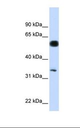 BABAM1 / HSPC142 Antibody - Hela cell lysate. Antibody concentration: 1.0 ug/ml. Gel concentration: 12%.  This image was taken for the unconjugated form of this product. Other forms have not been tested.
