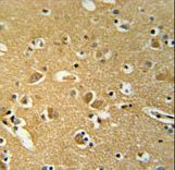 BABAM1 / HSPC142 Antibody - HSPC142 Antibody immunohistochemistry of formalin-fixed and paraffin-embedded human brain tissue followed by peroxidase-conjugated secondary antibody and DAB staining.