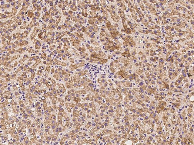 BABAM1 / HSPC142 Antibody - Immunochemical staining of human BABAM1 in human liver with rabbit polyclonal antibody at 1:100 dilution, formalin-fixed paraffin embedded sections.