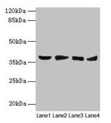 BABP / AKR1C2 Antibody - Western blot All lanes: Aldo-keto reductase family 1 member C2 antibody at 14µg/ml Lane 1: HepG2 whole cell lysate Lane 2: MCF-7 whole cell lysate Lane 3: Hela whole cell lysate Lane 4: Rat liver tissue Secondary Goat polyclonal to rabbit IgG at 1/10000 dilution Predicted band size: 37, 16 kDa Observed band size: 37 kDa