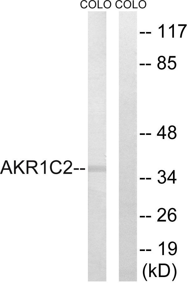 BABP / AKR1C2 Antibody - Western blot analysis of lysates from COLO cells, using AKR1C2 Antibody. The lane on the right is blocked with the synthesized peptide.