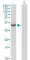 BABP / AKR1C2 Antibody - Western Blot analysis of AKR1C2 expression in transfected 293T cell line by AKR1C2 monoclonal antibody (M03), clone 3C11.Lane 1: AKR1C2 transfected lysate(36.7 KDa).Lane 2: Non-transfected lysate.