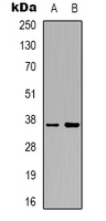 BABP / AKR1C2 Antibody - Western blot analysis of AKR1C2 expression in HepG2 (A); HeLa (B) whole cell lysates.