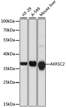 BABP / AKR1C2 Antibody - Western blot analysis of extracts of various cell lines, using AKR1C2 antibody at 1:1000 dilution. The secondary antibody used was an HRP Goat Anti-Rabbit IgG (H+L) at 1:10000 dilution. Lysates were loaded 25ug per lane and 3% nonfat dry milk in TBST was used for blocking. An ECL Kit was used for detection and the exposure time was 10s.