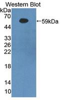 BACE1 / BACE Antibody - Western blot of BACE1 / BACE antibody.