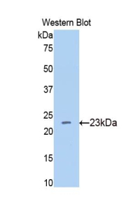 BACE1 / BACE Antibody - Western blot of recombinant BACE1 / BACE.  This image was taken for the unconjugated form of this product. Other forms have not been tested.