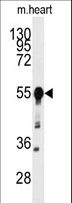 BACE1 / BACE Antibody - Western blot of anti-BACE1 Antibody in mouse heart tissue lysates (35 ug/lane). BACE1(arrow) was detected using the purified antibody.