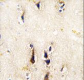 BACE1 / BACE Antibody - Formalin-fixed and paraffin-embedded human brain tissue reacted with BACE1 antibody , which was peroxidase-conjugated to the secondary antibody, followed by DAB staining. This data demonstrates the use of this antibody for immunohistochemistry; clinical relevance has not been evaluated.