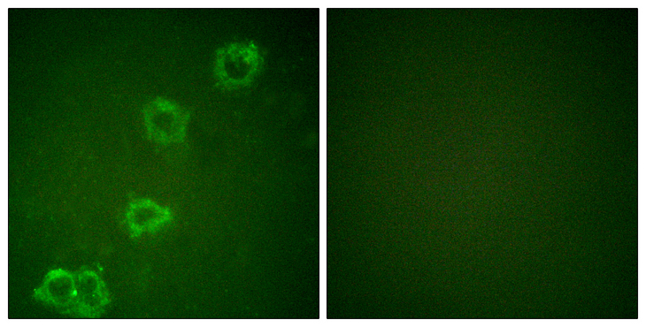 BACE1 / BACE Antibody - Immunofluorescence analysis of HUVEC cells, using BACE Antibody. The picture on the right is blocked with the synthesized peptide.