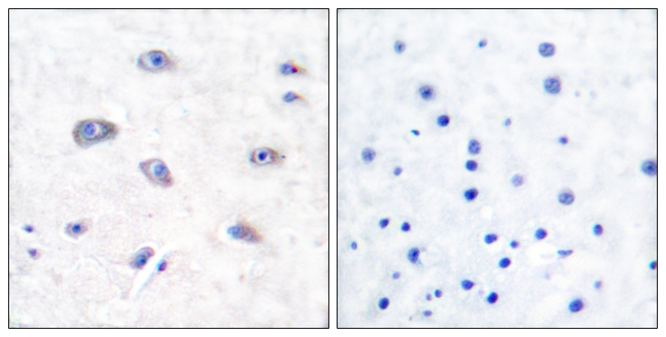 BACE1 / BACE Antibody - Immunohistochemistry analysis of paraffin-embedded human brain tissue, using BACE Antibody. The picture on the right is blocked with the synthesized peptide.