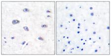 BACE1 / BACE Antibody - Immunohistochemistry analysis of paraffin-embedded human brain tissue, using BACE Antibody. The picture on the right is blocked with the synthesized peptide.